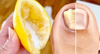 Lemon and Salt: A Natural Cure for Stubborn Toenail Fungus