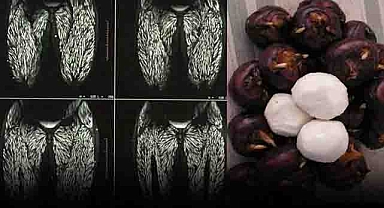 One Bite, Big Consequences: The Foodborne Parasites Hiding in Everyday Foods